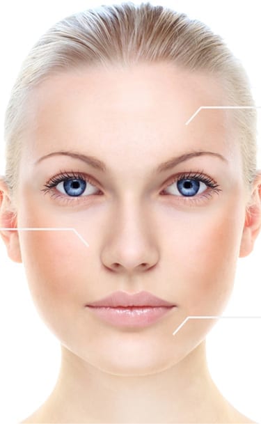 acne treatment