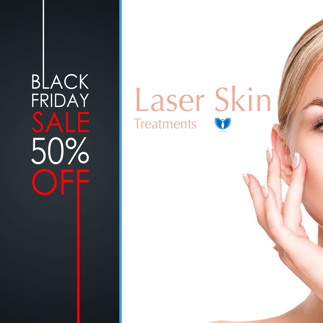 PAGE-1_READY_LASER-Carosel-Ads_Black-Friday_Nov23,-2019 Black Friday Sale