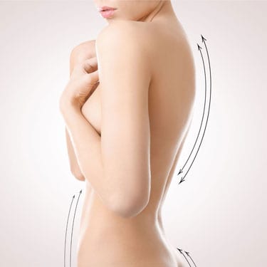 Coolsculpting-promotion-mob